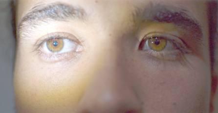 Pupil examination, close up of eyes